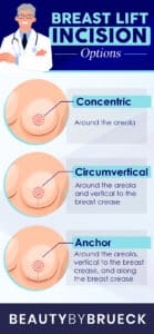 Breast Lift Fort Myers FL