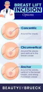 Breast lift Incision lift options