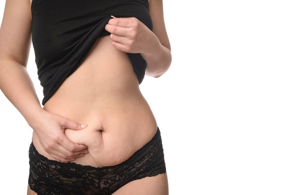 Can Liposuction Help Skin Shrink? 656f1b80a3990.jpeg